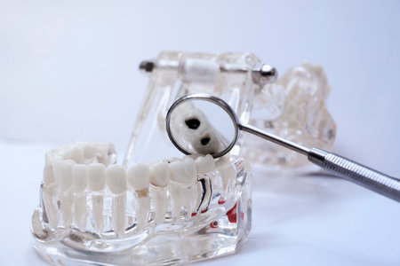 Model of the dental jaw and dental tool on a gray background. Dentist equipment and toolsの写真素材