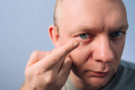 Man inserting clear transparent contact lens in eye. Correction of myopia eyesightの写真素材