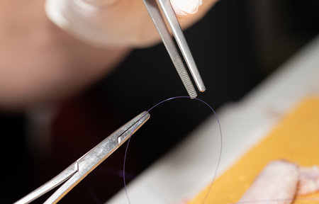 Close-up of a surgical clamp and forceps gripping surgical suture material. In the background, a blurred hand in a glove and a blurred surgical specimen.の写真素材
