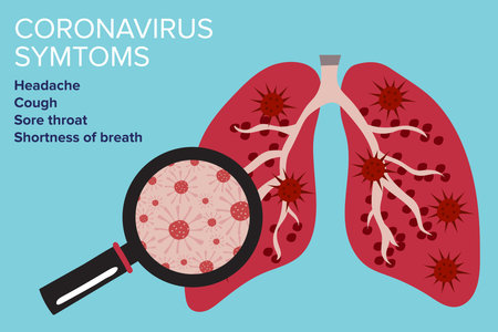 Sign Infographic with Cartoon has Cough, Fever, Sore Throat and Cold in Coronavirus or Covid-19 Outbreak. Healthy lungs and disease lungs. Vector Illustration.のイラスト素材