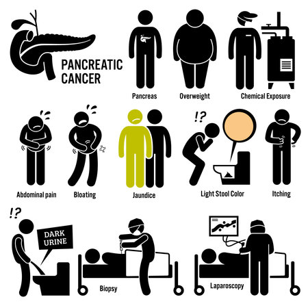 Pancreatic Pancreas Cancer Symptoms Causes Risk Factors Diagnosis Stick Figure Pictogram Iconsのイラスト素材