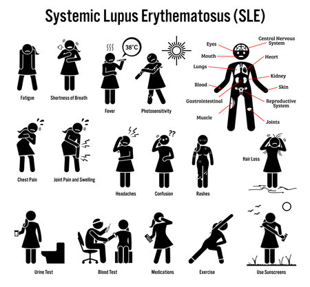 Systemic Lupus Erythematosus SLE Autoimmune Disease Icons. Pictogram depicts signs, symptoms, diagnosis, and treatment of lupus SLE disease.のイラスト素材