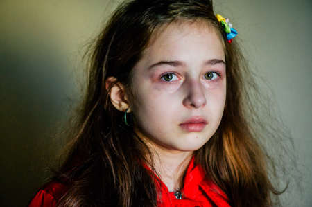 little sad girl after crying. Crying little beautiful girl with sad green eyes and frowning face. Teenager in a sad moodの写真素材