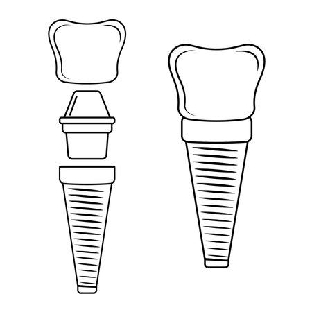 Dental implant, contour. Screw prosthesis, Illustration of dental implantation,orthodontic dental implantationのイラスト素材