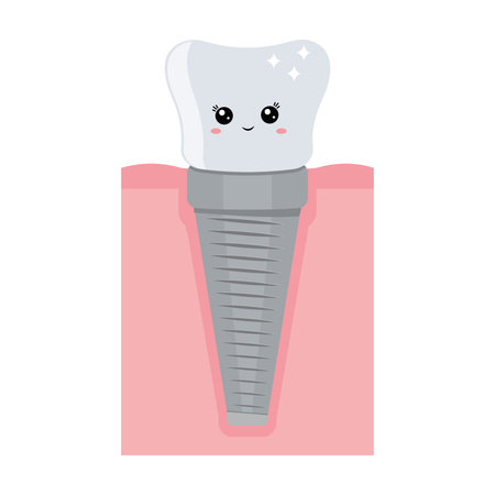 A dental implant, a kawaii character. Screw prosthesis, Illustration of dental implantation,orthodontic dental implantationのイラスト素材