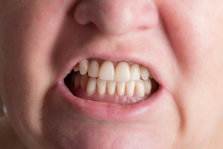 Prosthetics and orthodontic treatment. A woman demonstrates removable dentures.の写真素材