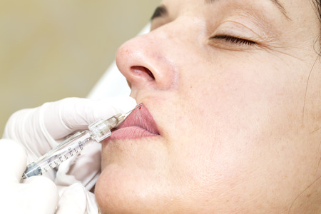 Cosmetic treatment with injection in a clinicの写真素材