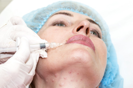 Cosmetic treatment with injection in a clinicの写真素材
