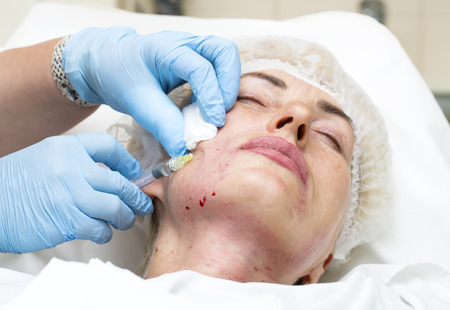 Cosmetic treatment with injection in a clinicの写真素材