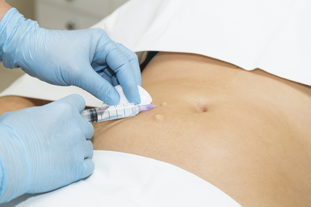 woman is in the process cellulite mesotherapy clinicの写真素材