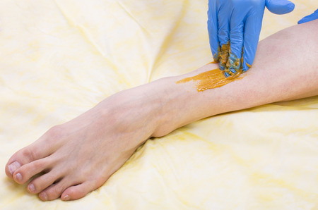 Epilation sugar processes woman passes in a beauty salonの写真素材