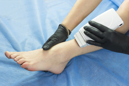 Process depilation female legs and hands in a beauty salonの写真素材