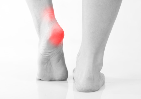 Closeup of woman's legs, heel and ankle painの写真素材