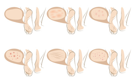 Woman foot concept of anti aging procedures on skin, vector sketches setのイラスト素材