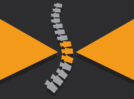 Lumbar spine pain, anatomy and medical conceptual vector illustrationのイラスト素材