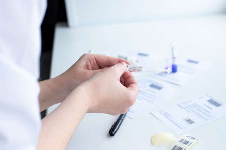 nurse prepares a test tube for venous blood sampling for analysis, diagnosis of diseases, blood test...