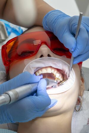 treatment of tooth decay. girl at the reception at the dentistの写真素材