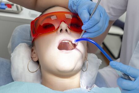 girl patient at the reception at the dentist. treatment of carious tooth. the girl lies on the dental chair with his mouth open. A dentist and his assistant are treating a toothの写真素材