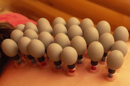 massage with vacuum cans. vacuum cans massotherapy spaの写真素材