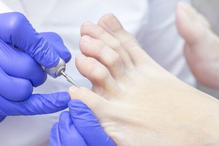 Therapeutic pedicure. Master podologist does hardware pedicure. visit to the podiatry. Foot...