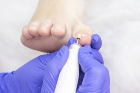 Therapeutic pedicure. Master podologist does hardware pedicure. visit to the podiatry. Foot treatment in the spa. Clinic of Podiatria.の写真素材
