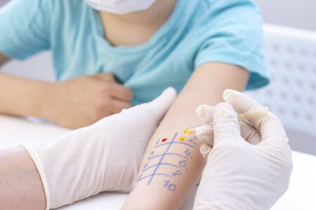 Allergen test on hand. child undergoing procedure of allergen skin test in clinic.