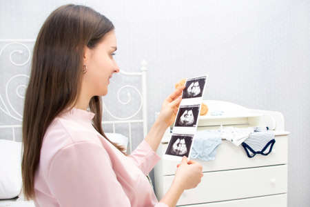 pregnant girl is looking at a sonogram. expectation of a child, motherhood.