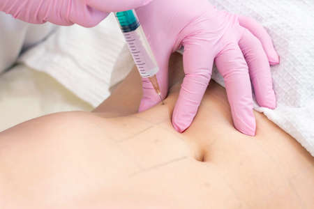 lipolytic injections are placed in the stomach. female hands in pink gloves inject a young woman into the stomach.の写真素材
