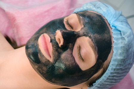 Young woman with carbon nanogel on her face in salon. Peeling procedure.の写真素材