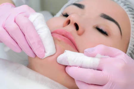 procedure for manual cleansing of the facial skin from blackheads and acne. beauty parlorの写真素材