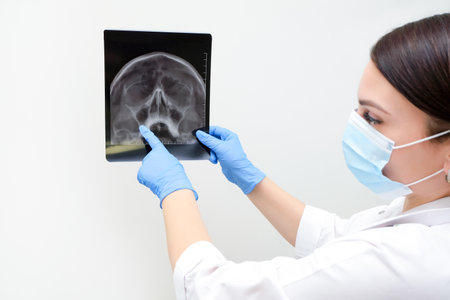 X-ray of the skull in the hand of a female doctor. With copy space. Diagnosis of sinusitisの写真素材
