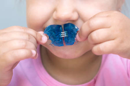 Dental plate. Expansion of the jaw in a child. A plate to heaven. There is not enough room for the molars. Happy girl holding an orthodontic plate in her handsの写真素材