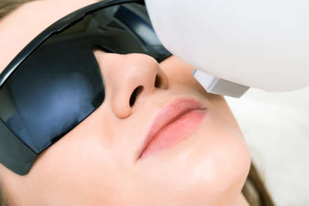 Laser hair removal of the mustache and chin of a young beautiful woman. Depilation on the face....