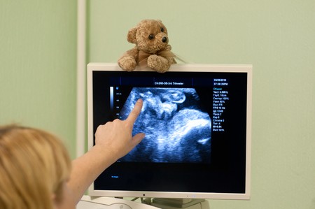 Obstetrician examining pregnant belly by ultrasonic scan.