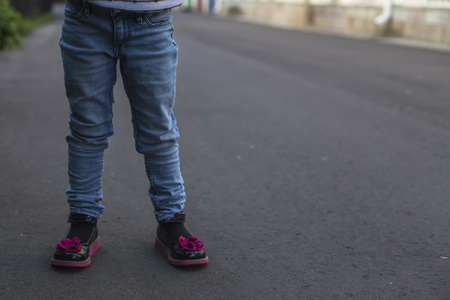 Girl wearing orthopedic shoes outdoorsの写真素材