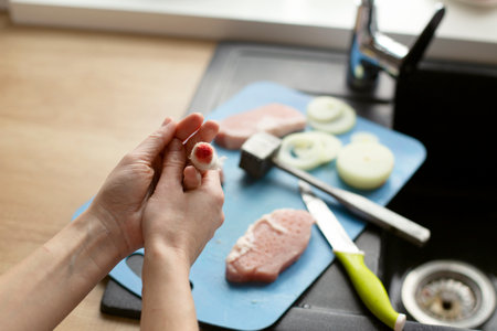 Close-up of a bandage on a finger. The woman injured her finger while cooking. Caring for a bloody wound at homeの写真素材