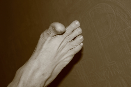 pale leg with fingers bursting sepia photo