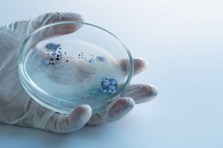 epidemic and the global virus attack concept. lab technician or researcher holds a Petri dish with a...