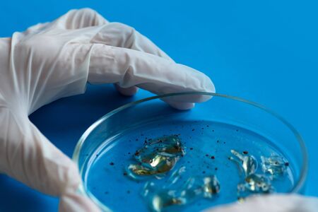 epidemic and the global virus attack concept. Laboratory tests different samples. Virology and...