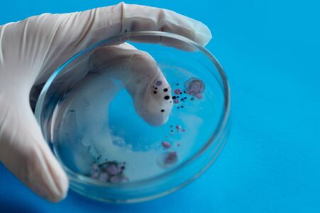 biologist or virologist holds a Petri dish with a sample. Gloved hands, close-upの写真素材