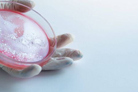 Research of viruses and bacteria, researcher holds a Petri dish with a sample. Epidemics of viral...