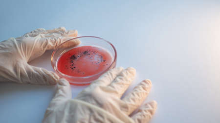 epidemic and the global virus attack concept. lab technician or researcher holds a Petri dish with a sample. Virology and bacteriologyの写真素材