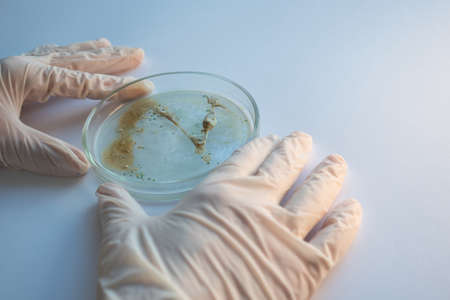 epidemic and the global virus attack concept. lab technician or researcher holds a Petri dish with a sample. Virology and bacteriologyの写真素材