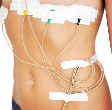 Woman wearing holter monitor device for daily monitoring of an electrocardiogram. Treatment of heart...
