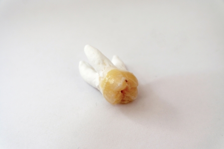 The first upper molarの写真素材