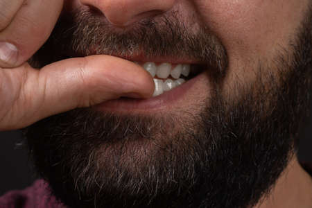 male lips with untrimmed beard at closeup. Close up of male part of face. man bites his nails. Bad...