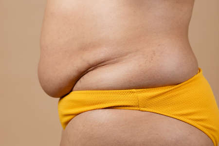 Cropped image of overweight fat pregnant woman sag stomach with obesity, excess fat in yellow pants. Fast weight loss.の写真素材