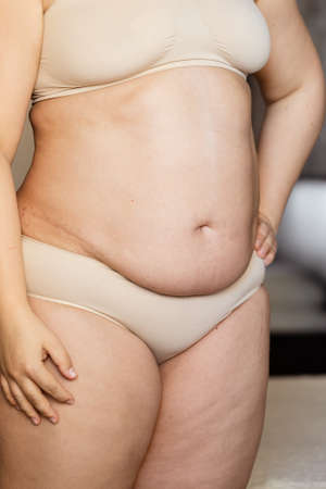 Cropped image overweight fat woman stomach with obesity, excess fat in underwear. Self acceptance, body positive. Closeの写真素材