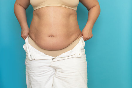 Cropped photo of plump obese woman pulling on white unzipped shorts, showing excess naked abdomen on blue background.の写真素材