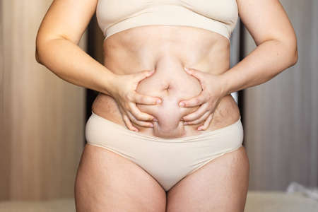 Cropped overweight fat woman holding tummy excess flabs. Fast weight loss, showing cellulite. Obesity stomach, celluliteの写真素材